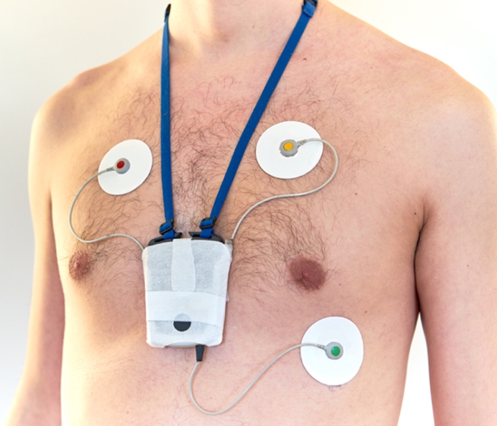 wearable heart monitor from doctor