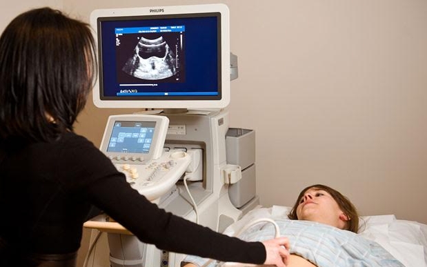 sonography tech